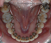 orthodontie Asnieres 92 
